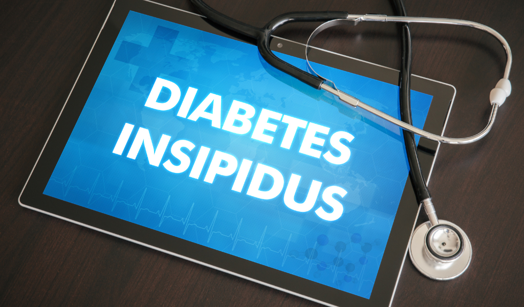 Mengenal Diabetes Insipidus