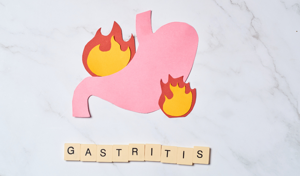 vitameal Resep Masakan Sehat dan Lezat untuk Penderita GERD Penting
