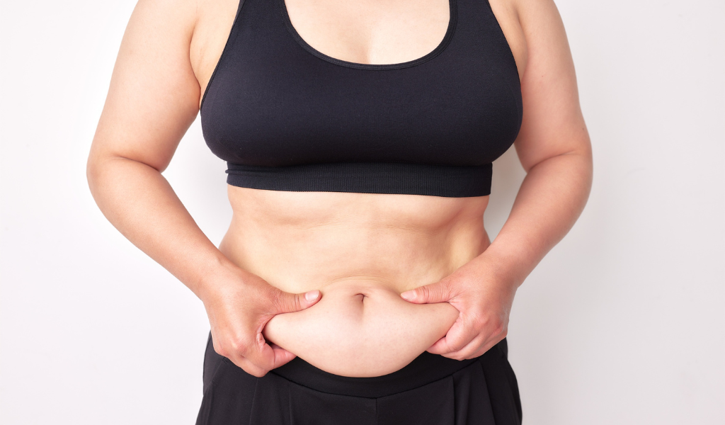 Bahaya Perut Buncit