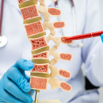 Penyakit pengeroposan tulang