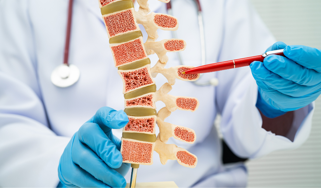 Sehatkan Tulang dan Sendi