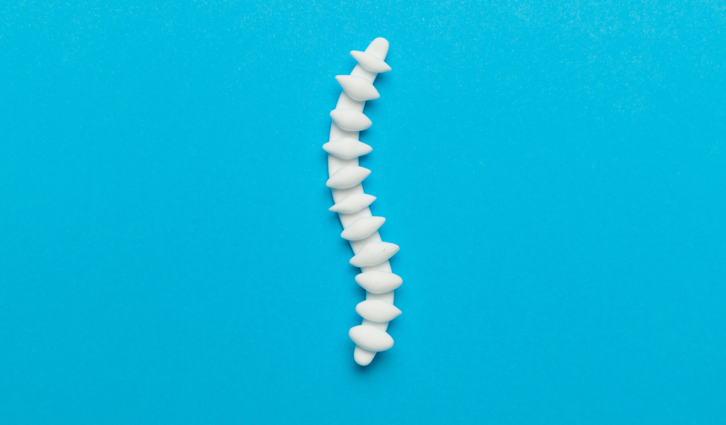 Cara Mencegah Osteoporosis